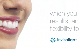 invisalign results and flexibility