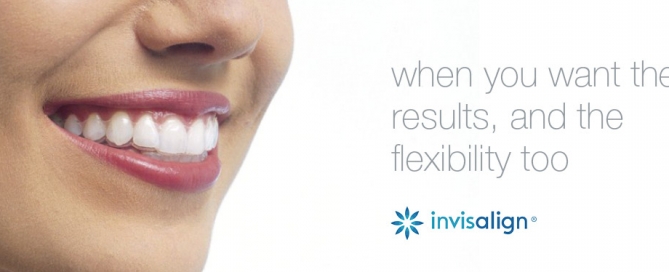 invisalign results and flexibility