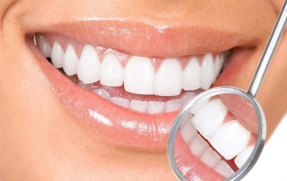 Tooth Whitening in Aliso Viejo