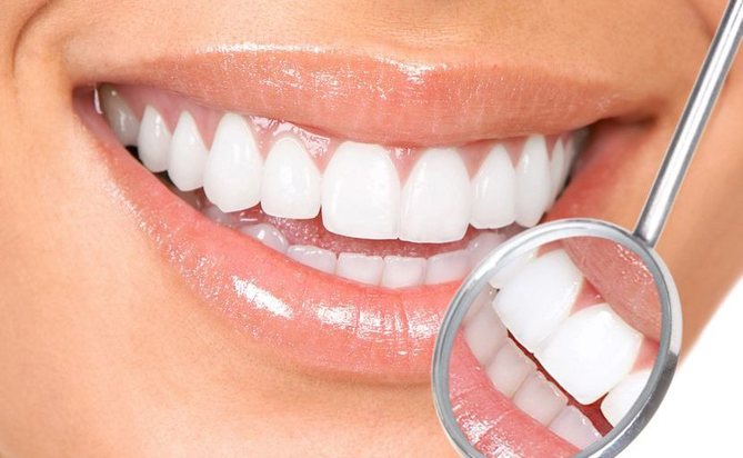 Tooth Whitening in Aliso Viejo
