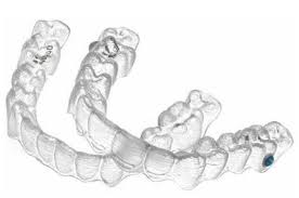 invisalign trays Aliso Viejo