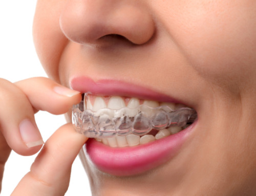 Why Choose Invisalign to Straighten Your Teeth