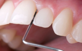 Healthy Gums and Teeth Cleaning, Aliso Viejo