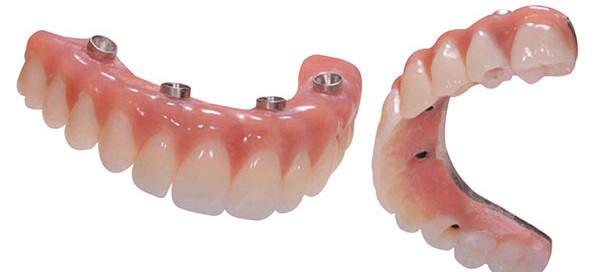 All-on-4 teeth, permenant teeth, dental implants