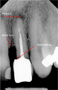 Digital X-rays