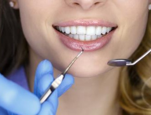 Unveiling Your Best Smile: Transforming Lives with a Smile Makeover by the Leading Cosmetic Dentist in Aliso Viejo