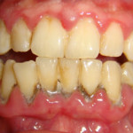 Cosmetic Dentistry