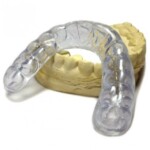 mouth guard