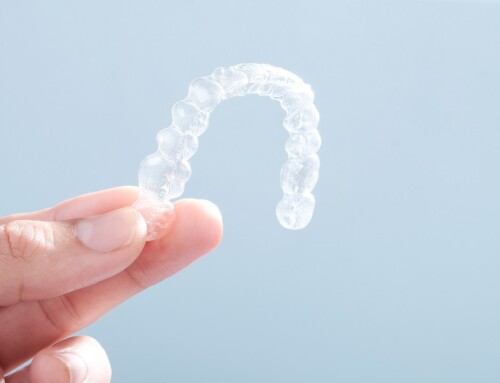Unveiling the Beauty of Invisalign Treatment in Aliso Viejo