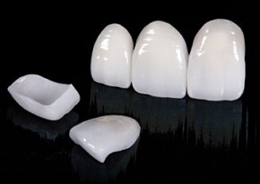 Porcelain Veneers