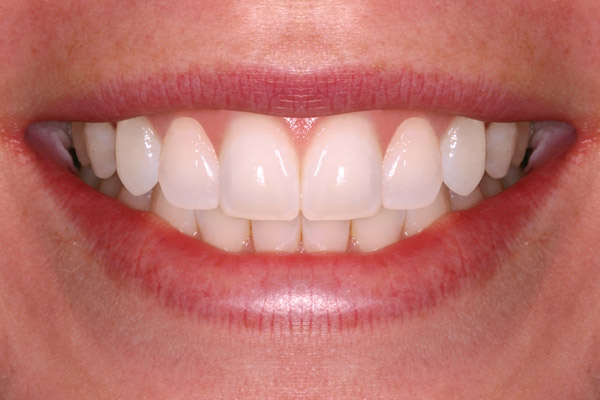 Cosmetic Dentistry