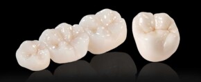 All Zirconai Dental Crowns