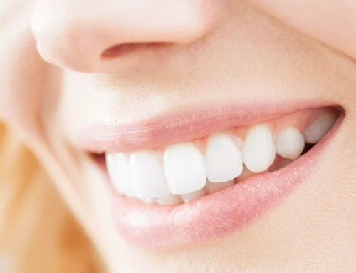 Brighten Your Smile the Right Way: What Californians Should Know About Teeth Whitening